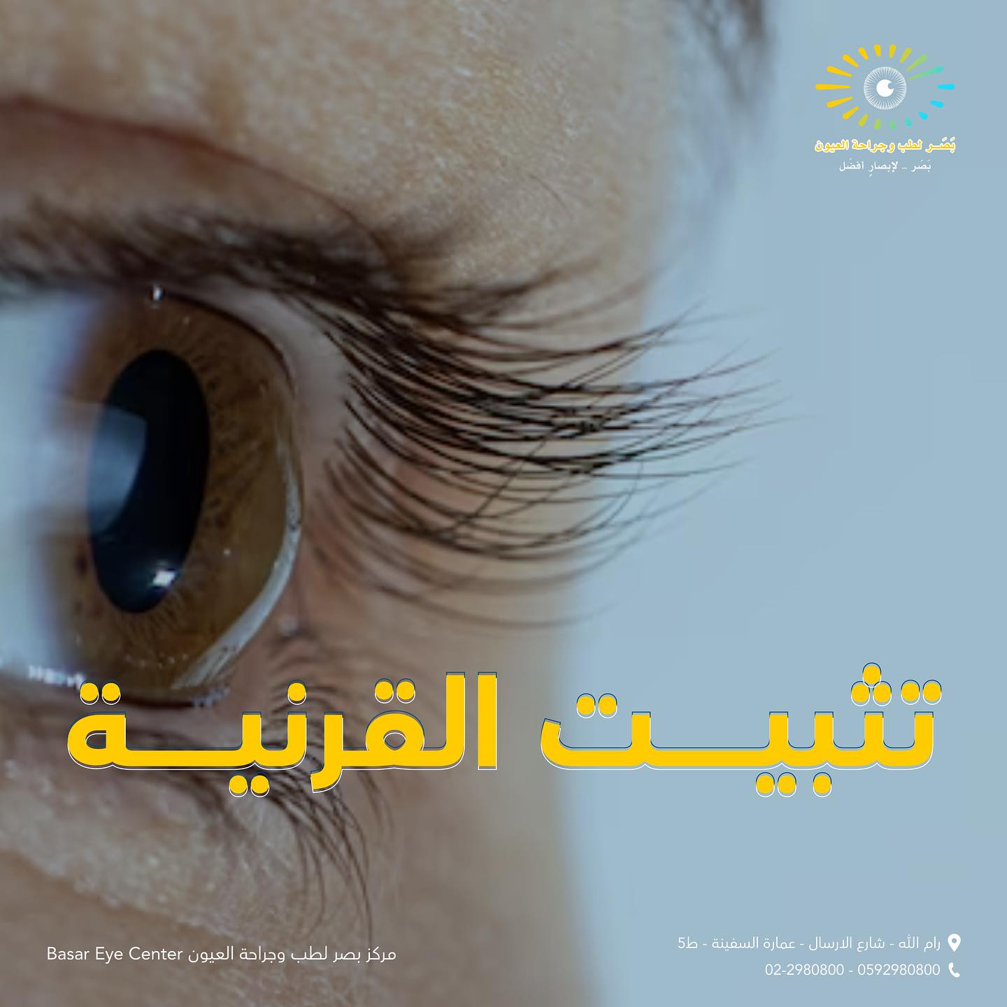  مركز بَصَر لطب وجراحة العيون - صورة 1
