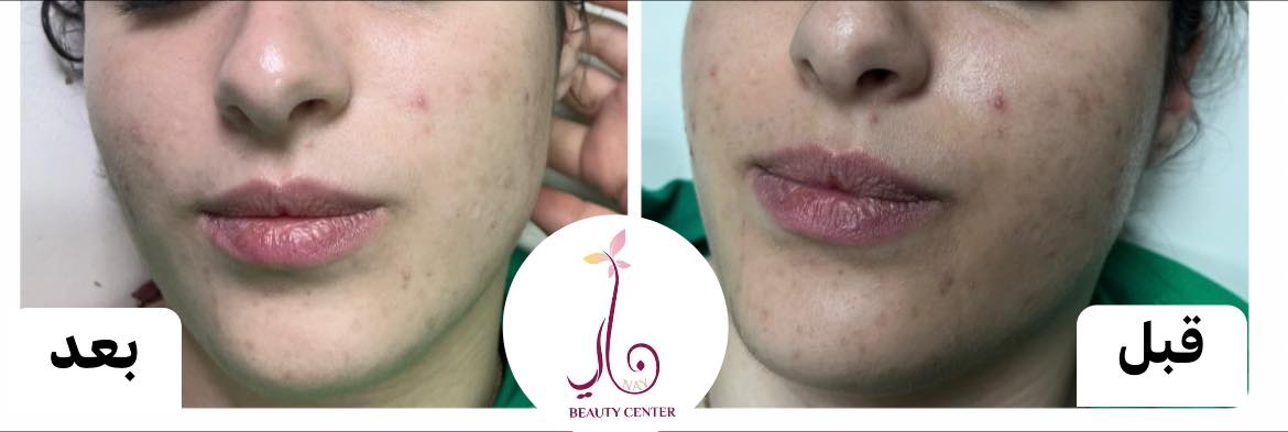 Nay Beauty Center - صورة 4