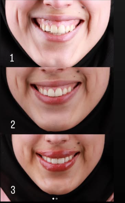 Dr.Reem Hummos - صورة 4