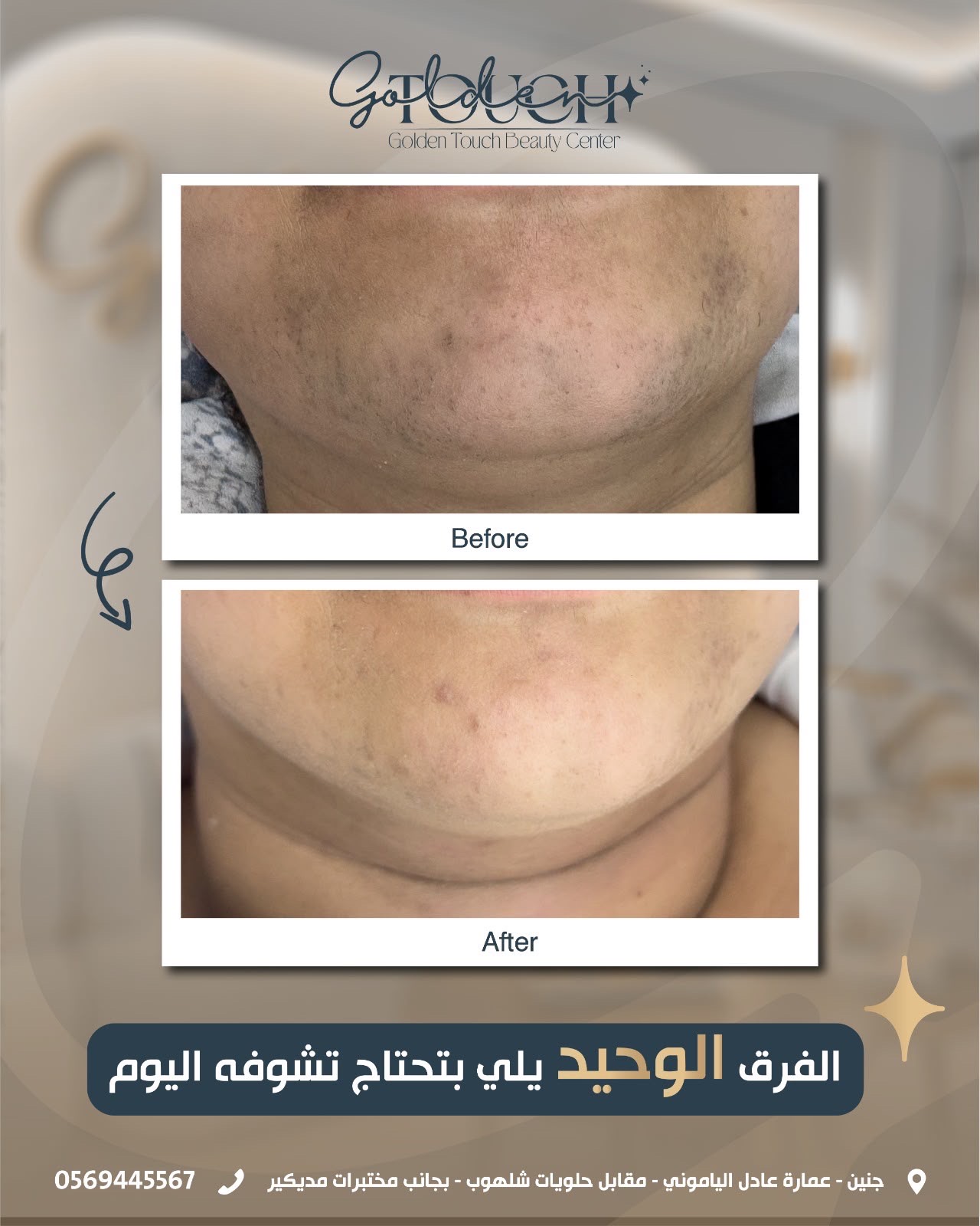 Golden Touch Beauty Center - صورة 6
