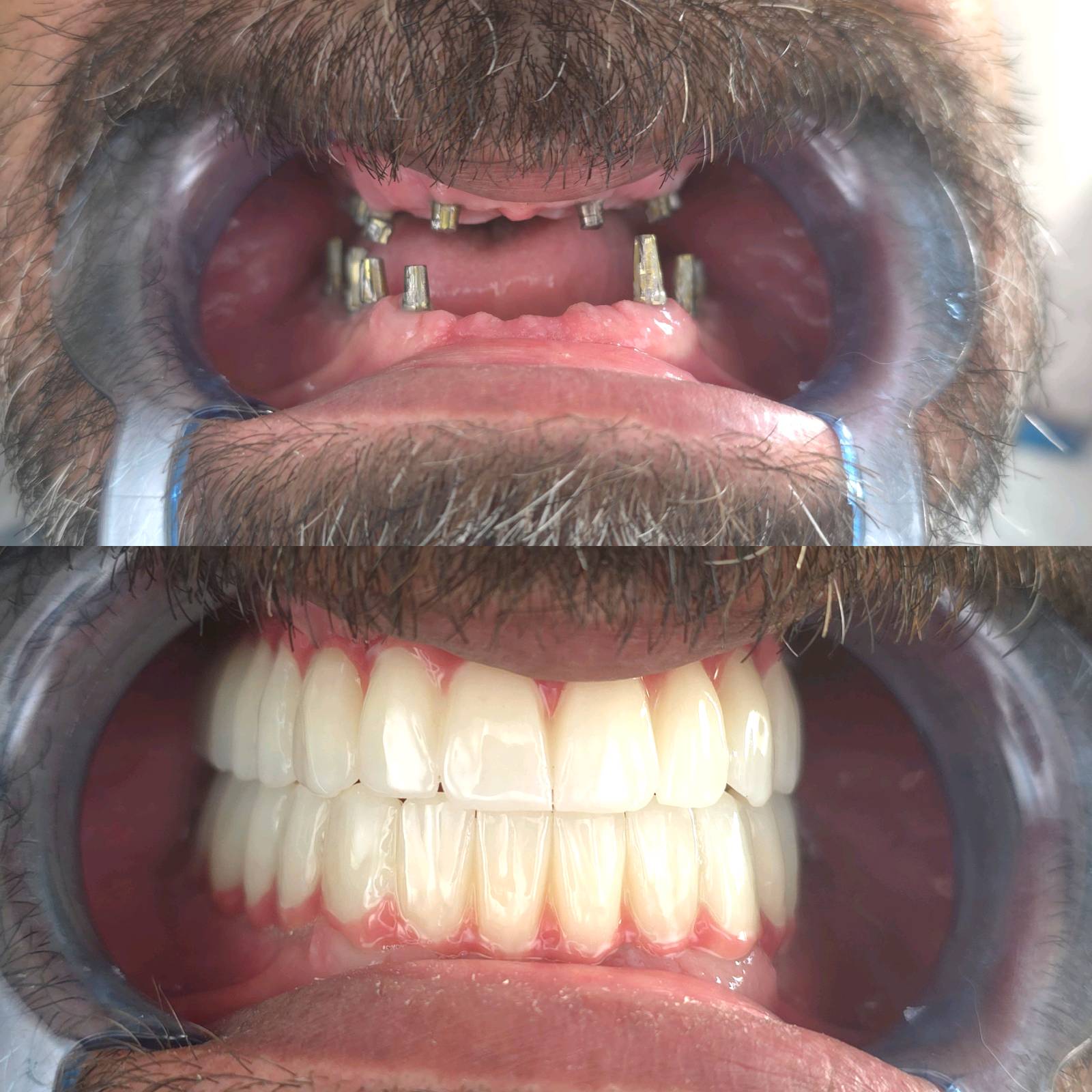 د.اوفى جبارين لطب الاسنان - صورة 2