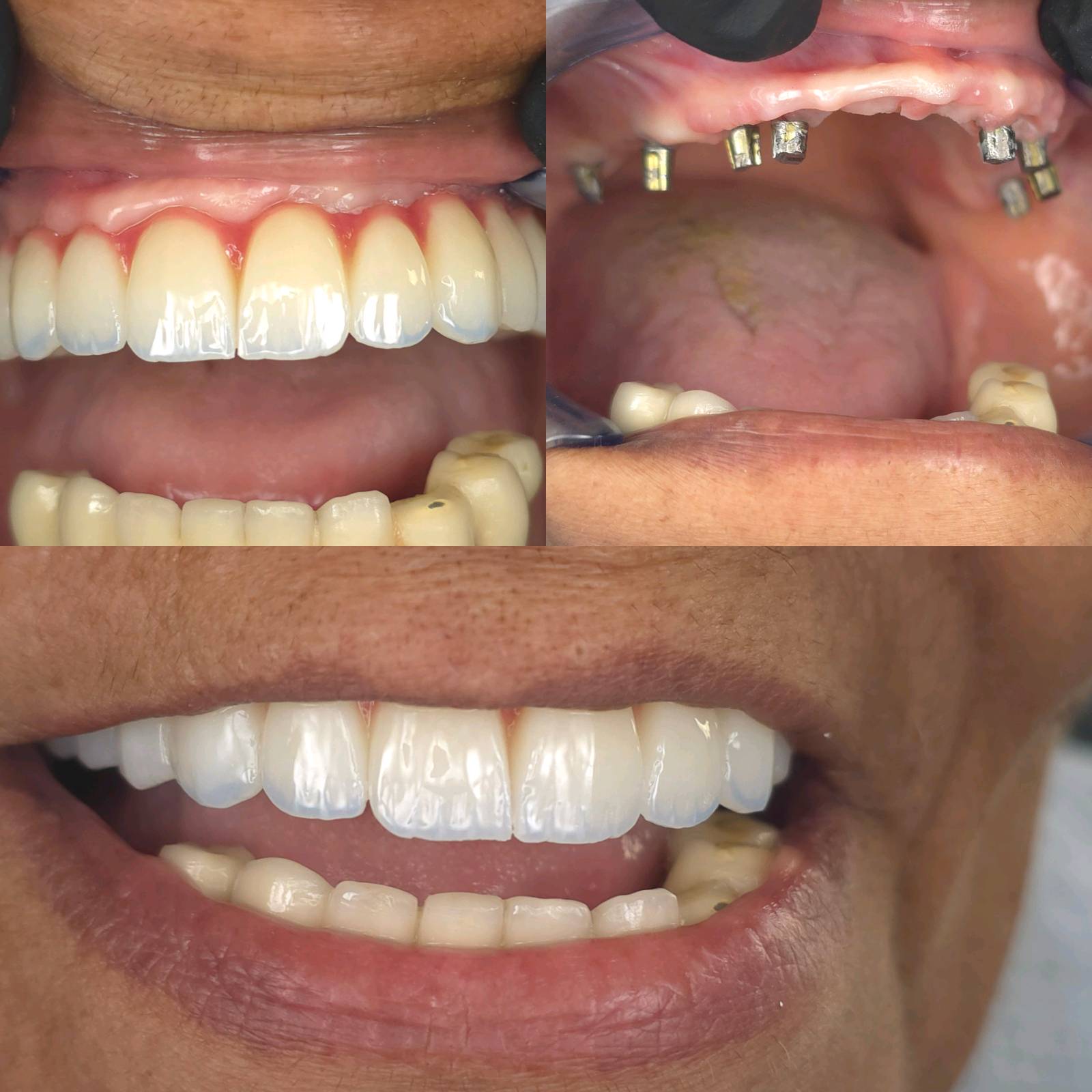 د.اوفى جبارين لطب الاسنان - صورة 3