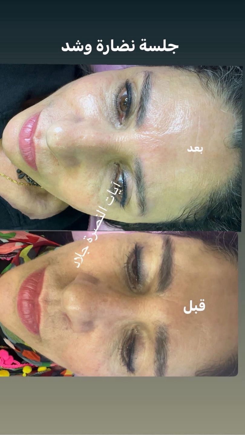 قصر نور الشمس - صورة 5