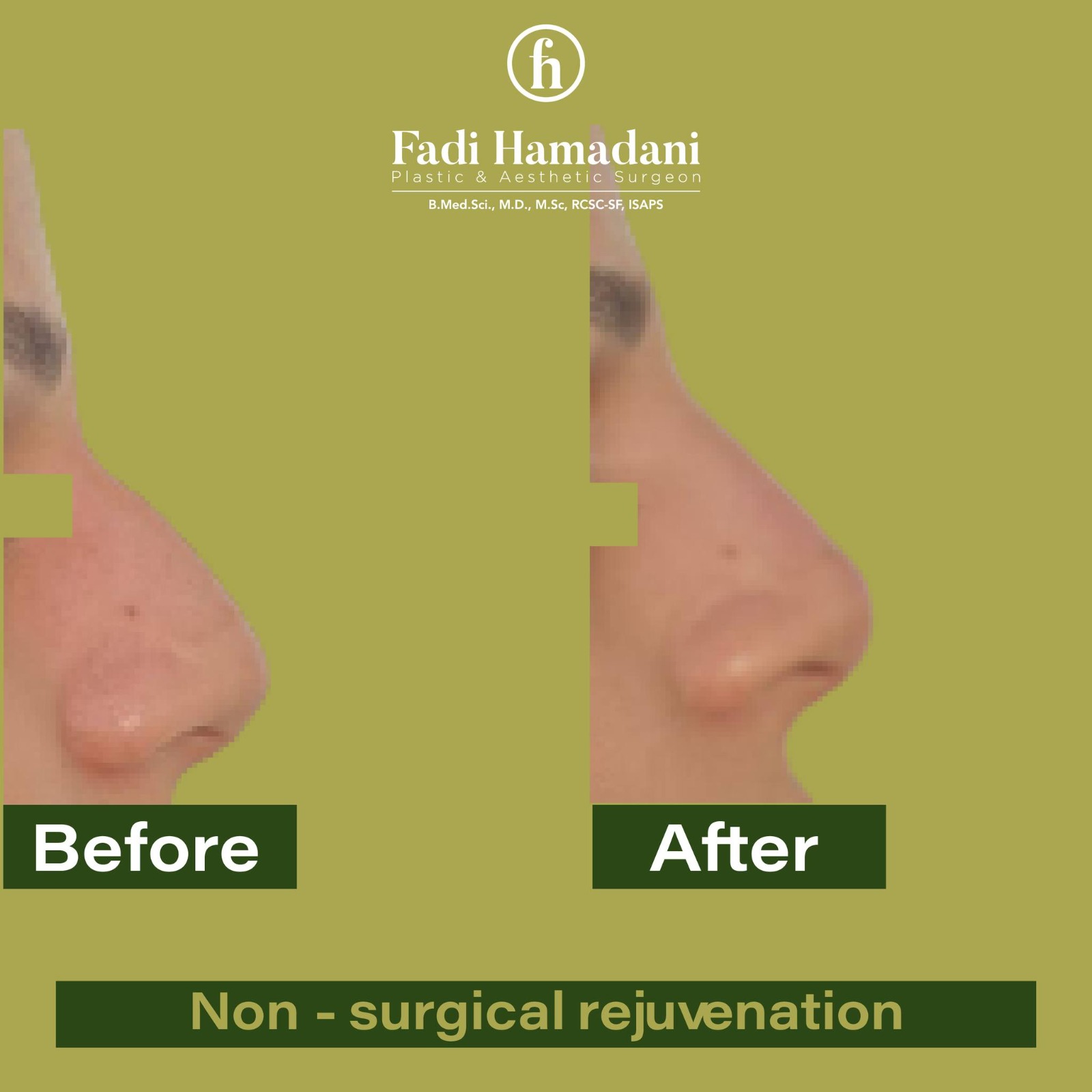 Dr. Fadi Hamadani, Plastic & Aesthetic Clinic - صورة 1