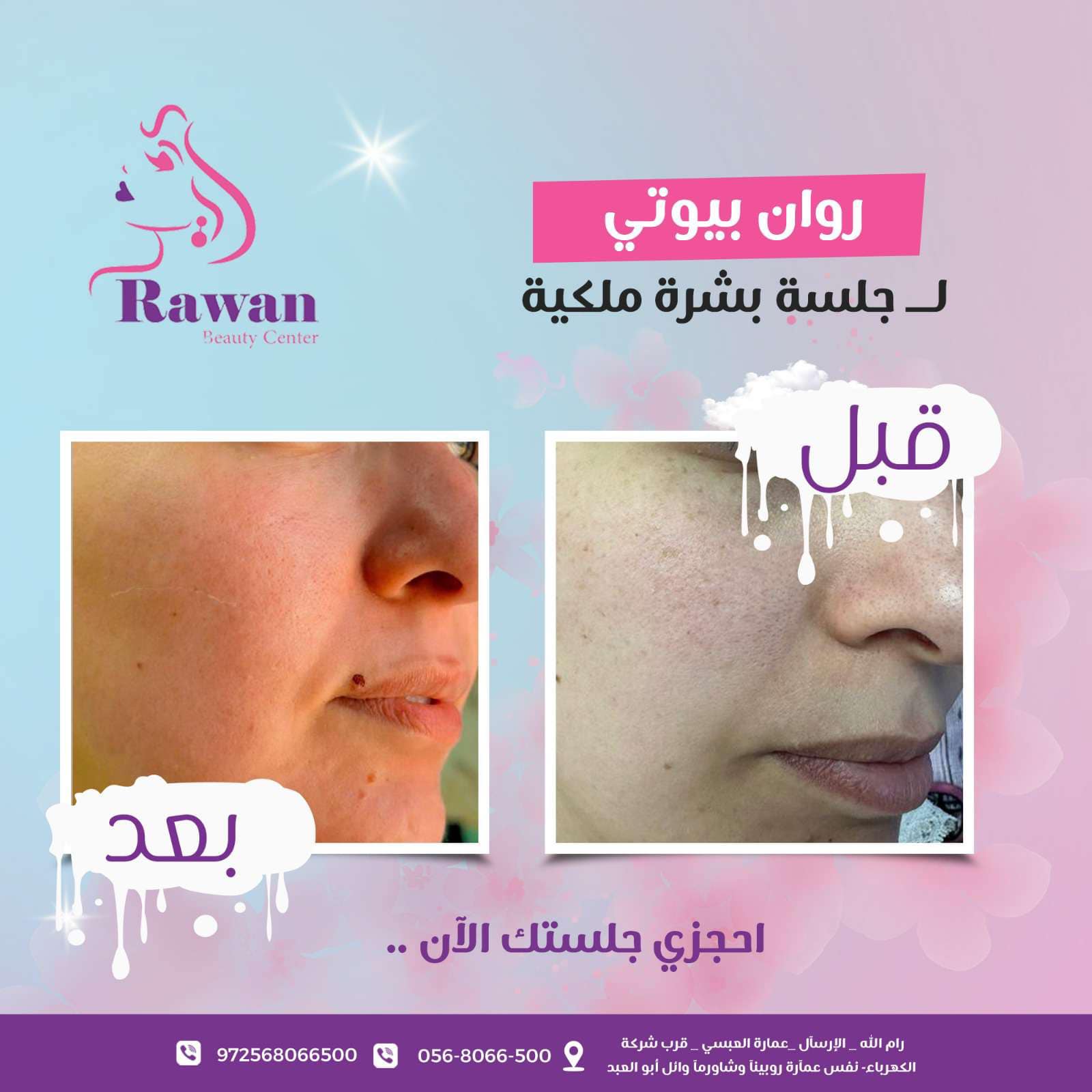 Rawan Beauty Center - صورة 6