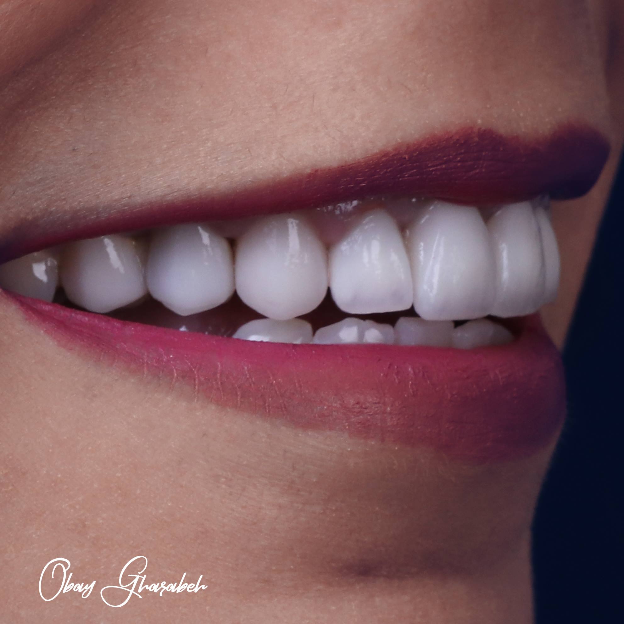 dr.obay gharaba - صورة 8