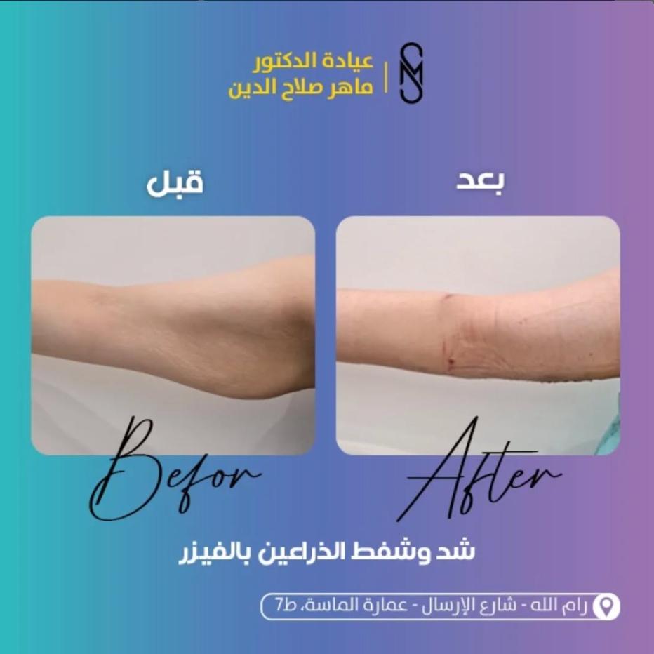 د. ماهر صلاح الدين لجراحة السمنة وشفط الدهون - صورة 7