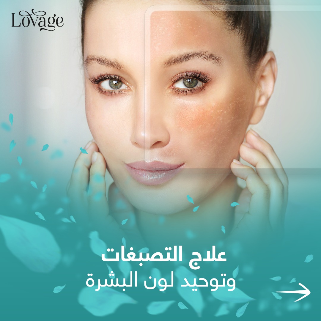 Lovage - صورة 2