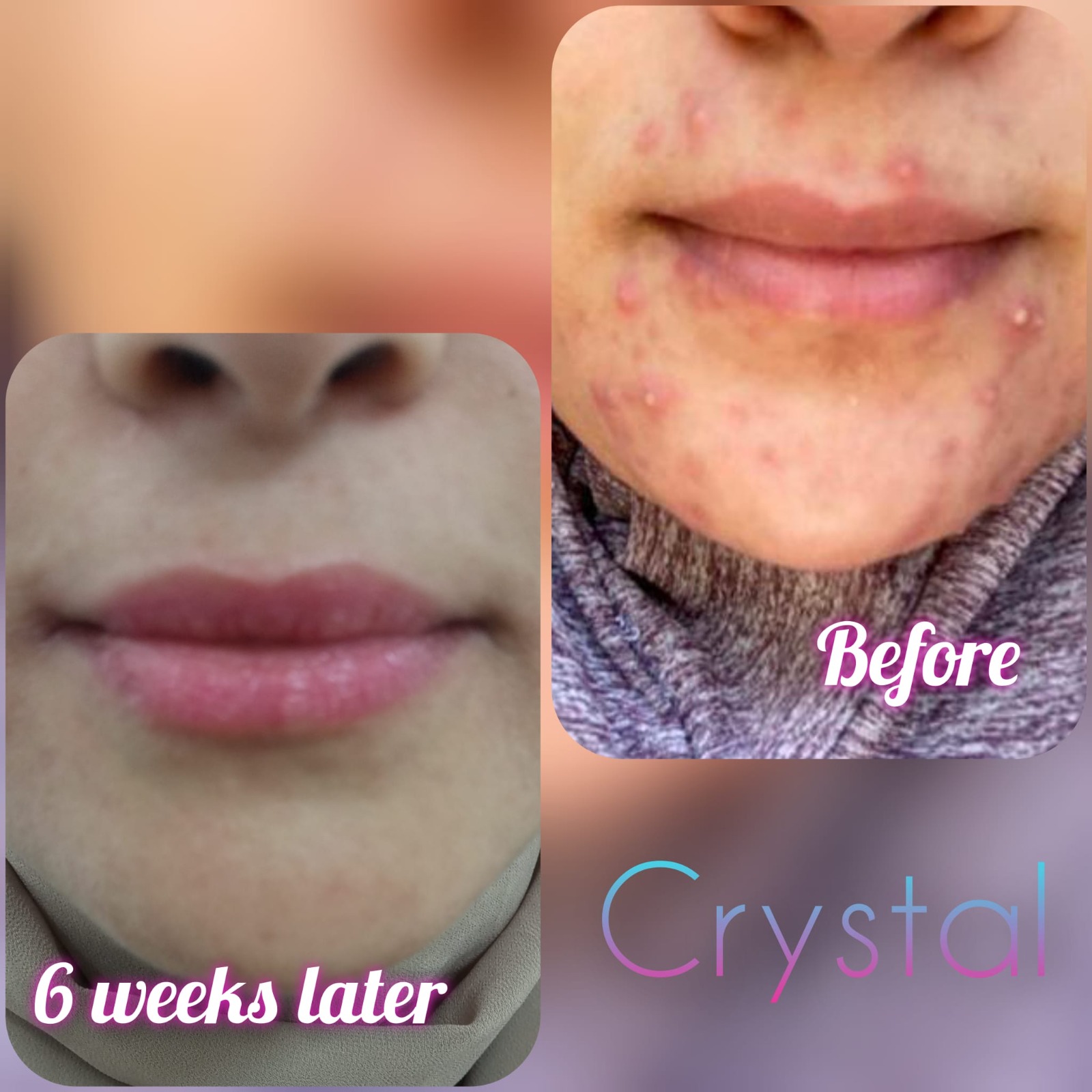 Crystal Beauty Laser & more - صورة 2