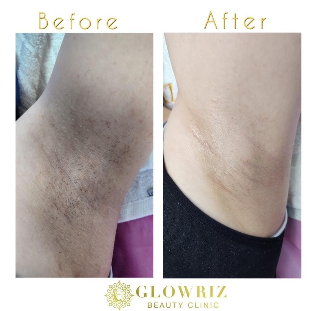 Glowriz Beauty Clinic - صورة 3