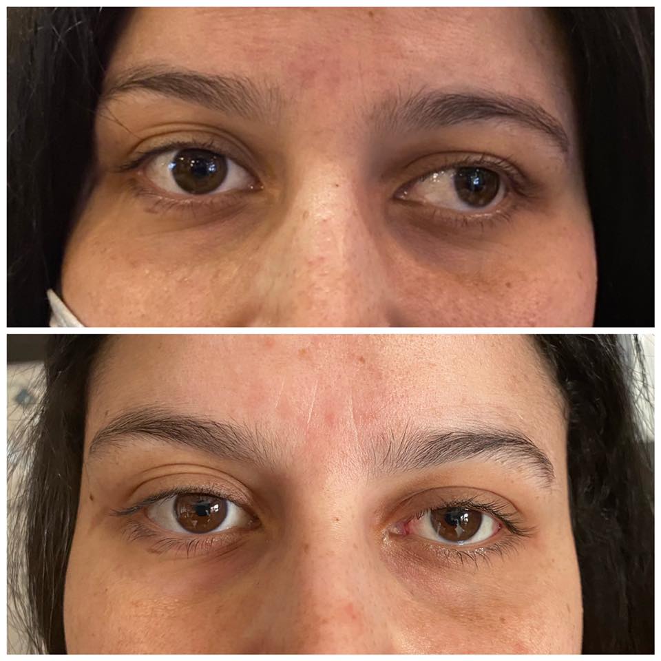 مركز الليزك وجراحة القرنية المخروطية - O CliniC - صورة 3