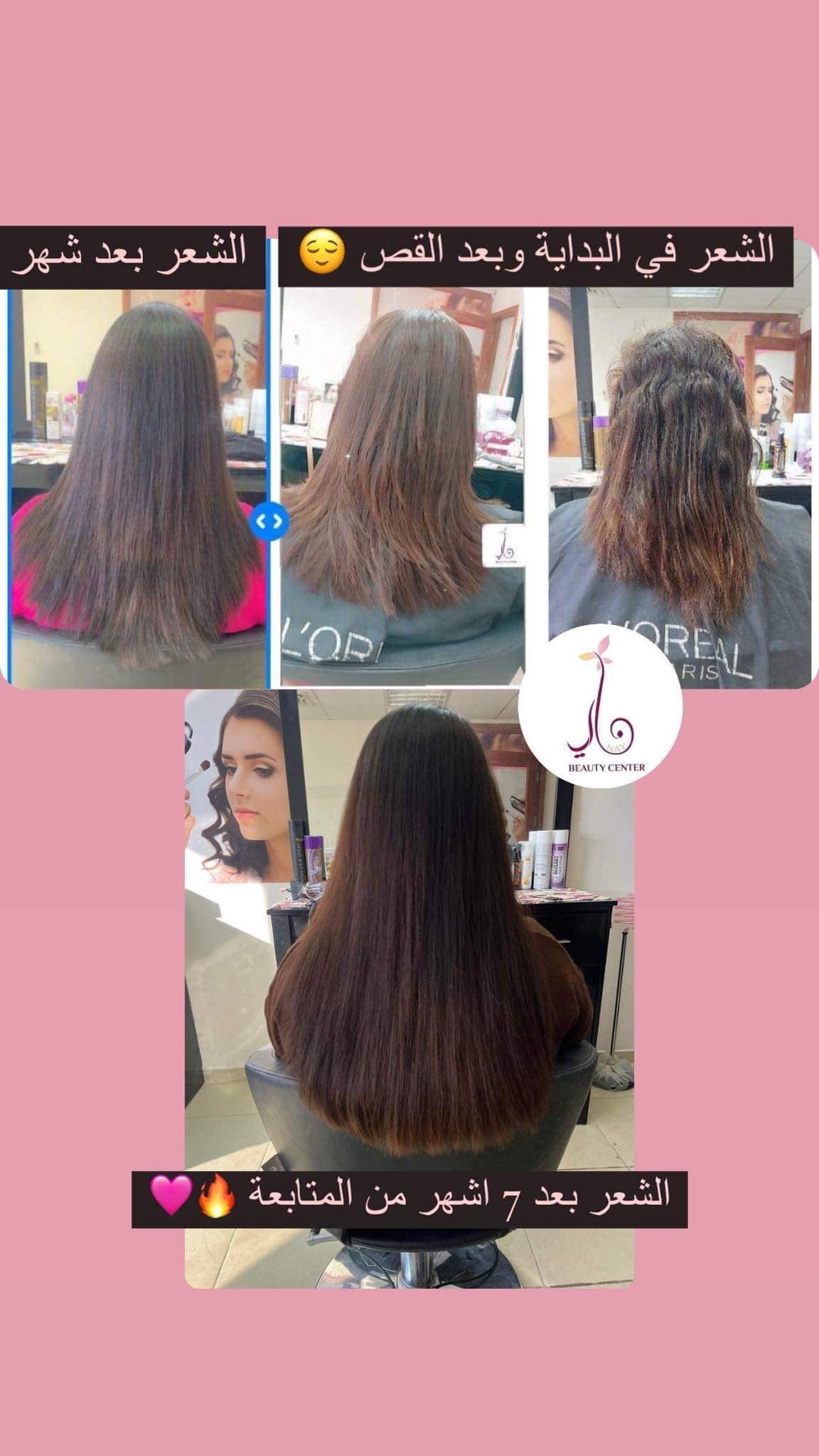 Nay Beauty Center - صورة 7