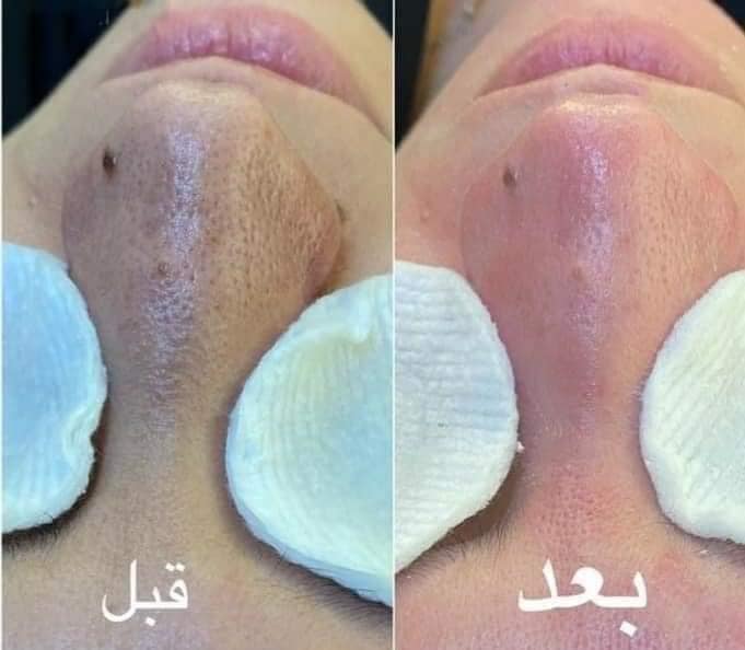 Rawan Beauty Center - صورة 2
