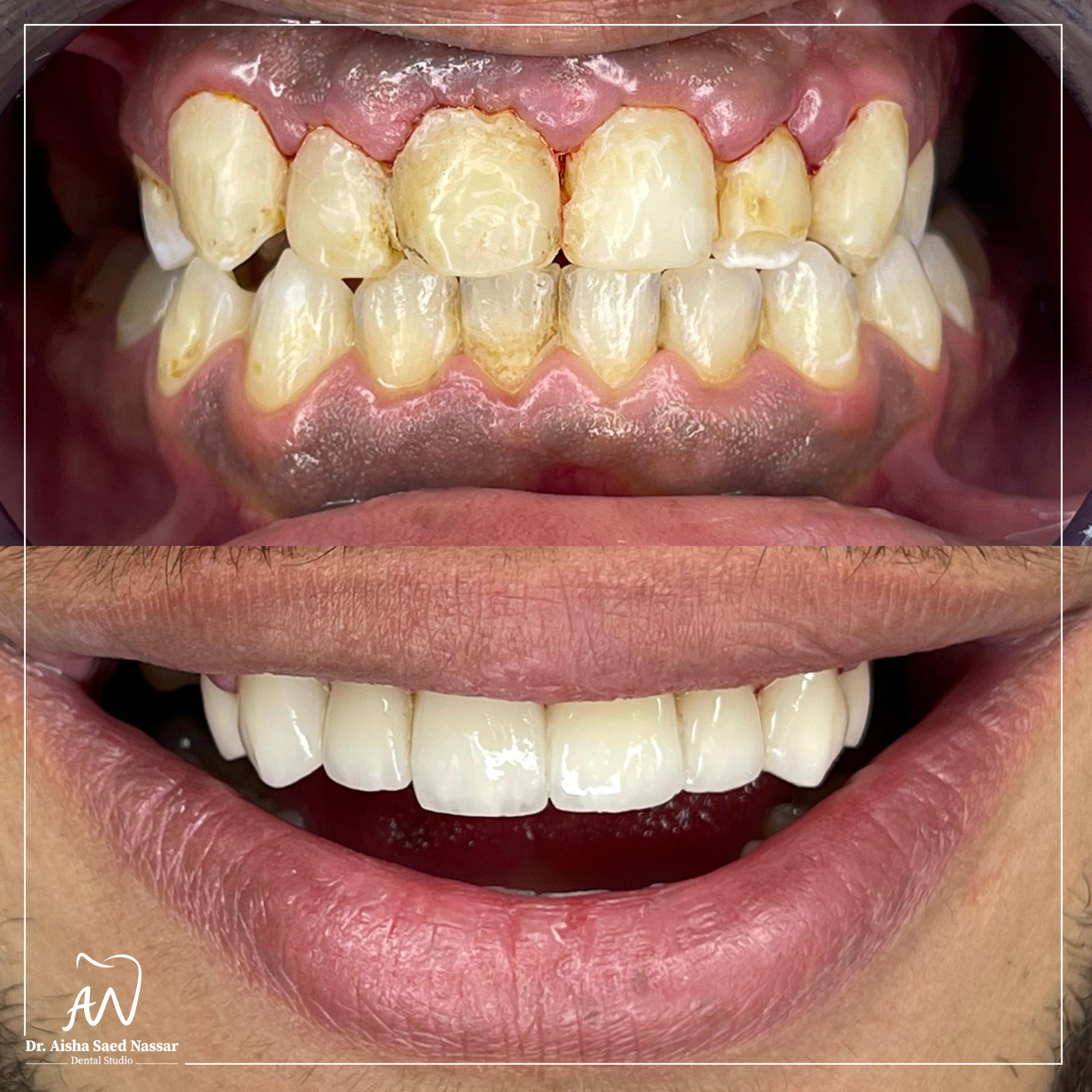 Dr.Aisha Saed Nassar د.عايشة سعد نصار - صورة 3