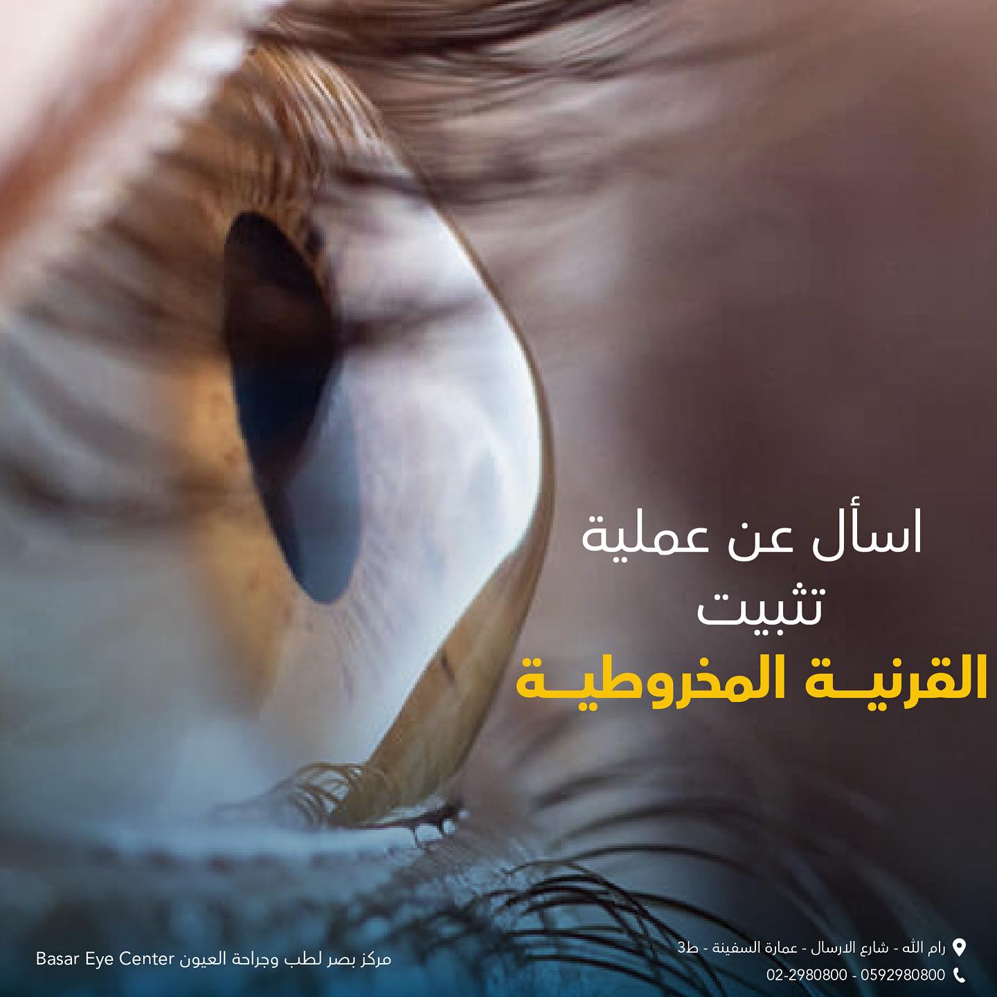  مركز بَصَر لطب وجراحة العيون - صورة 4