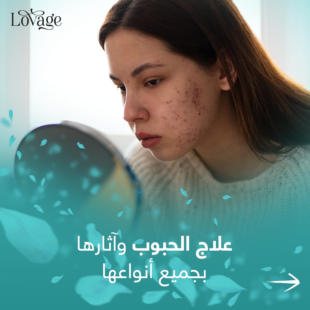 Lovage - صورة 5
