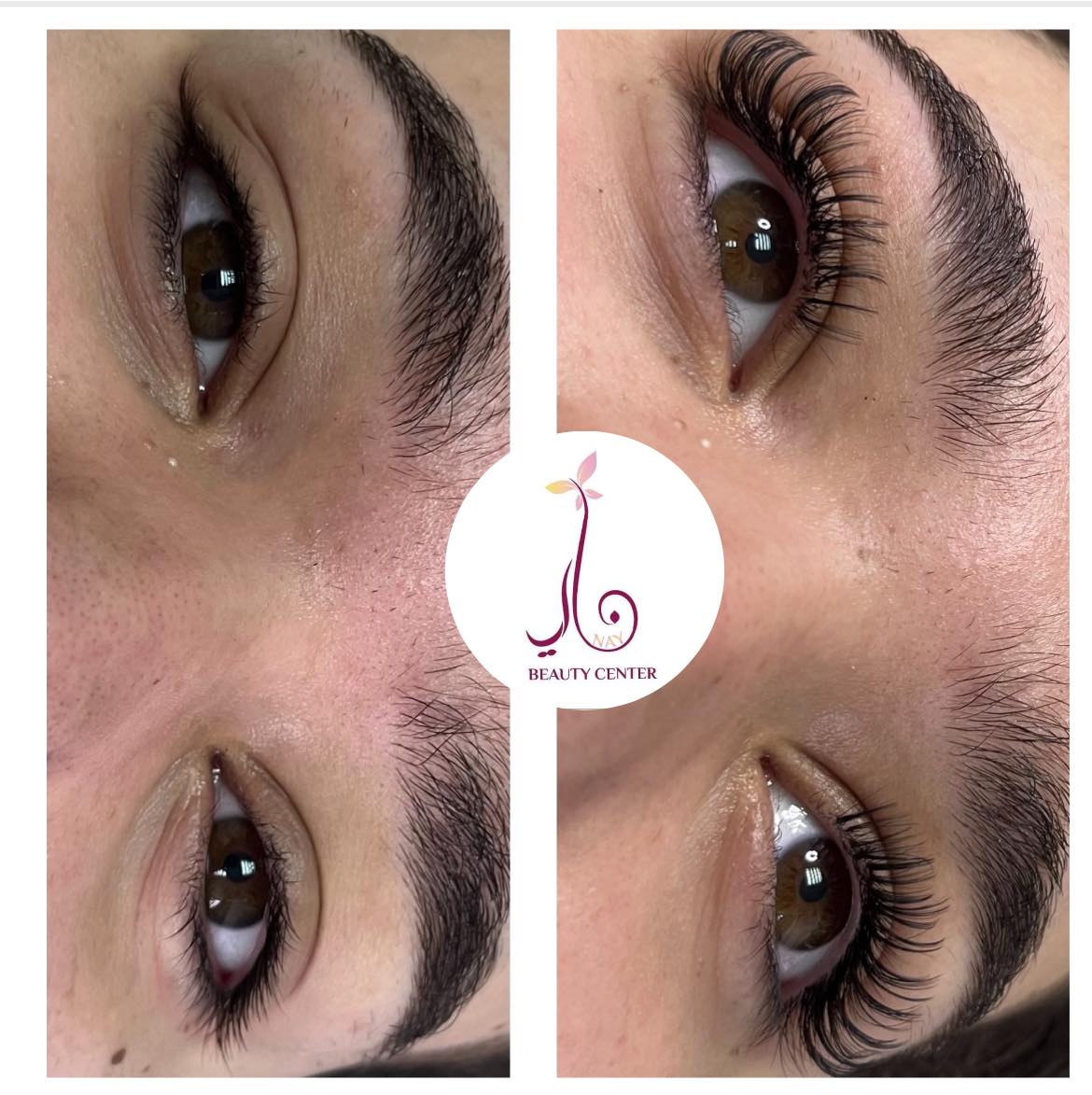 Nay Beauty Center - صورة 2