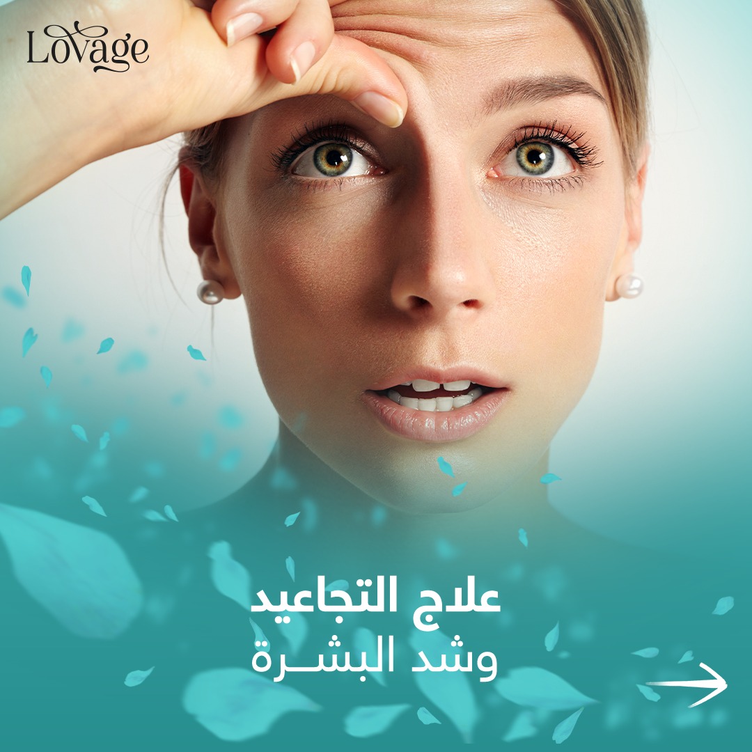 Lovage - صورة 4