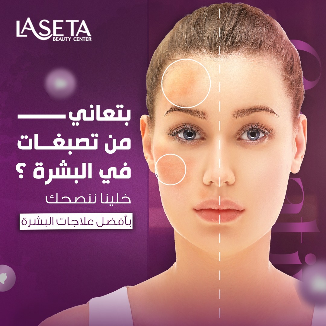 LaSeta - صورة 4