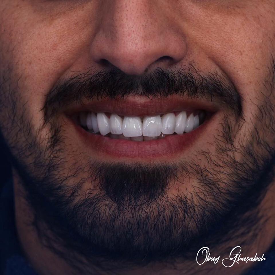 dr.obay gharaba - صورة 7