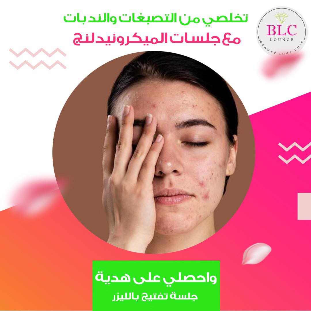 BLC Lounge - صورة 1