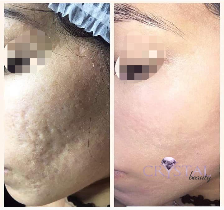 Crystal Beauty Laser & more - صورة 1