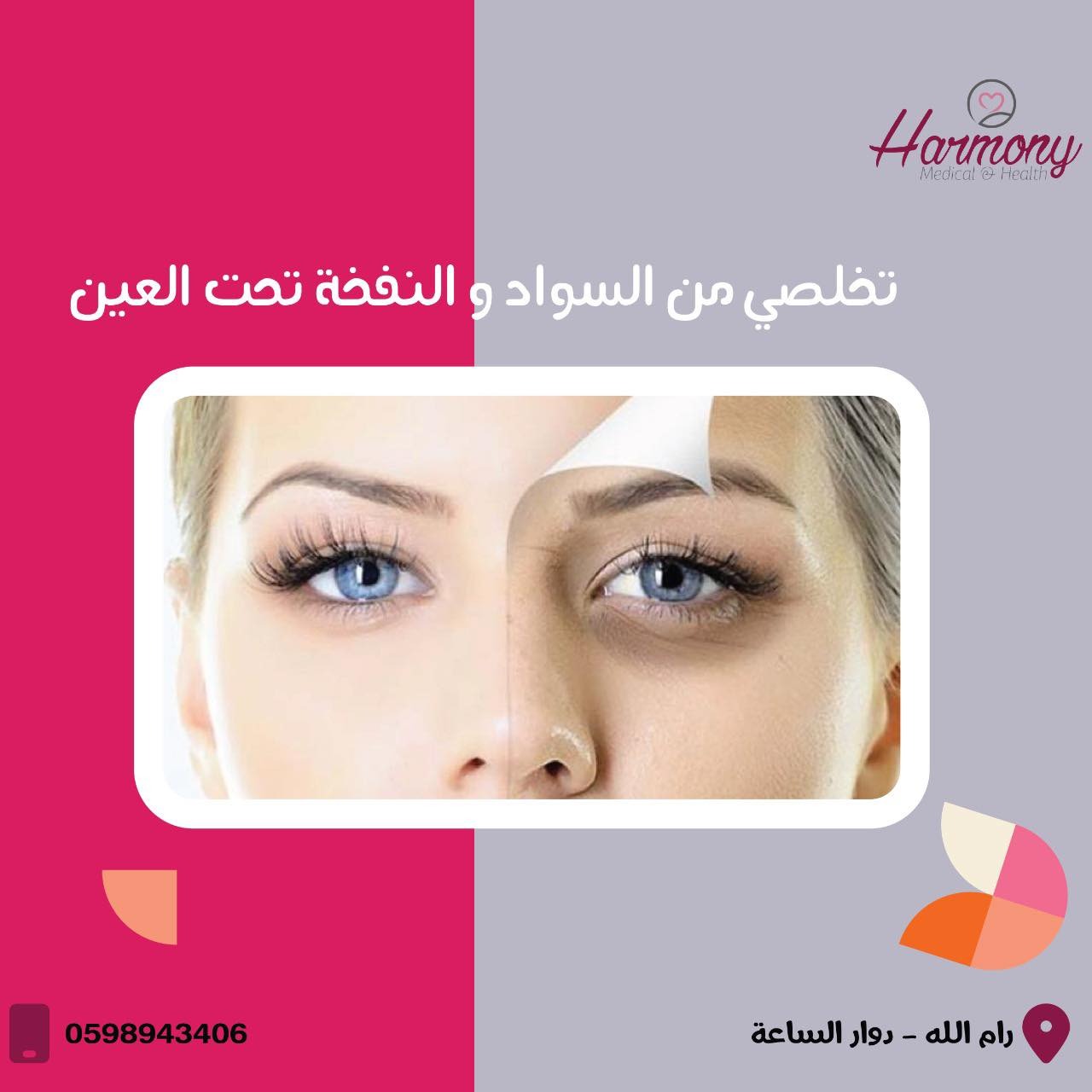 مركز هارموني الطبي للتجميل - صورة 4