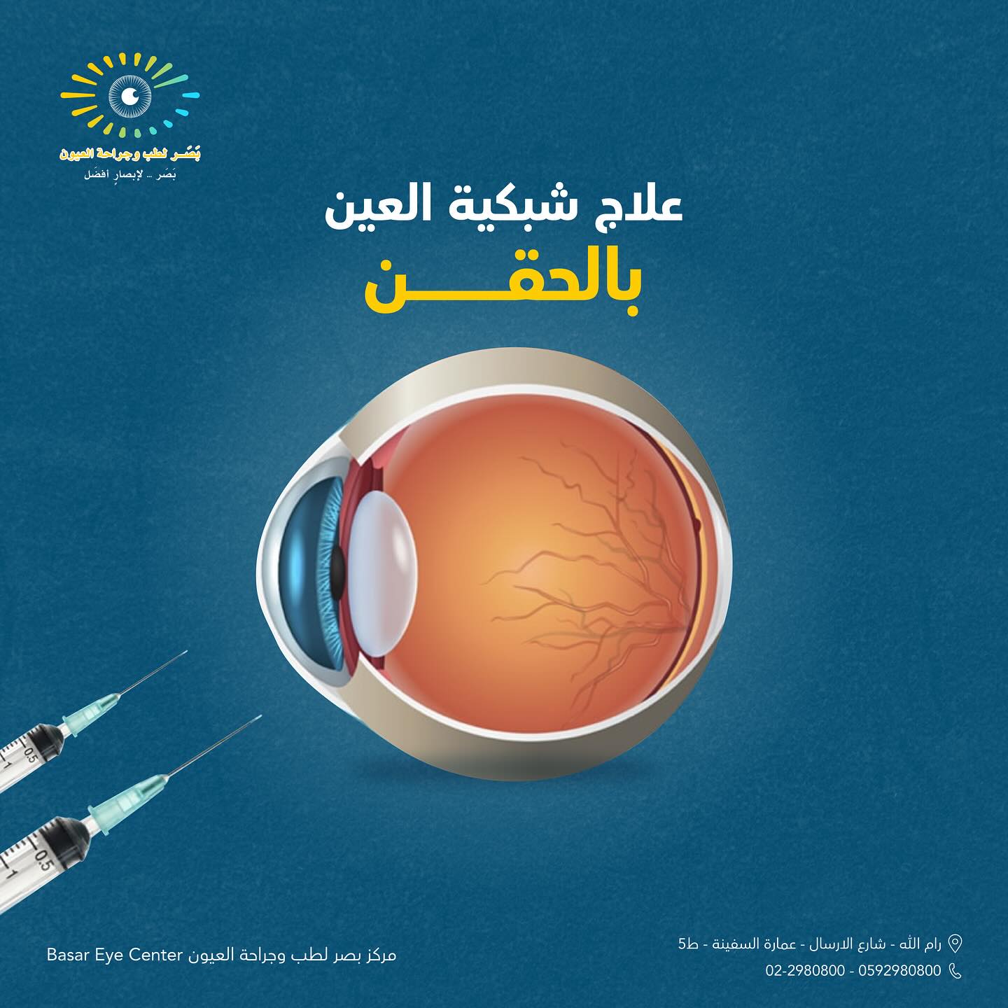  مركز بَصَر لطب وجراحة العيون - صورة 7