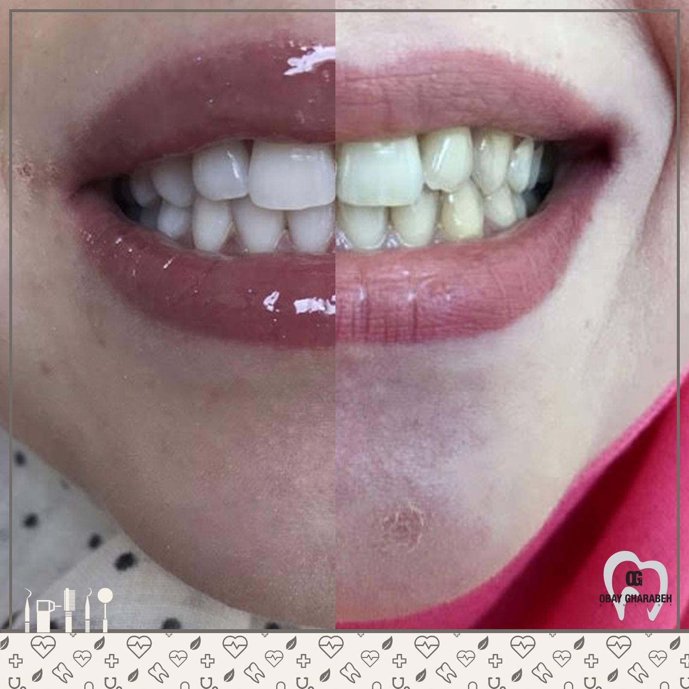dr.obay gharaba - صورة 5