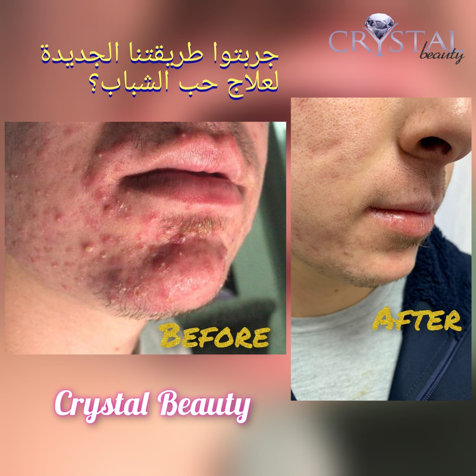 Crystal Beauty Laser & more - صورة 3