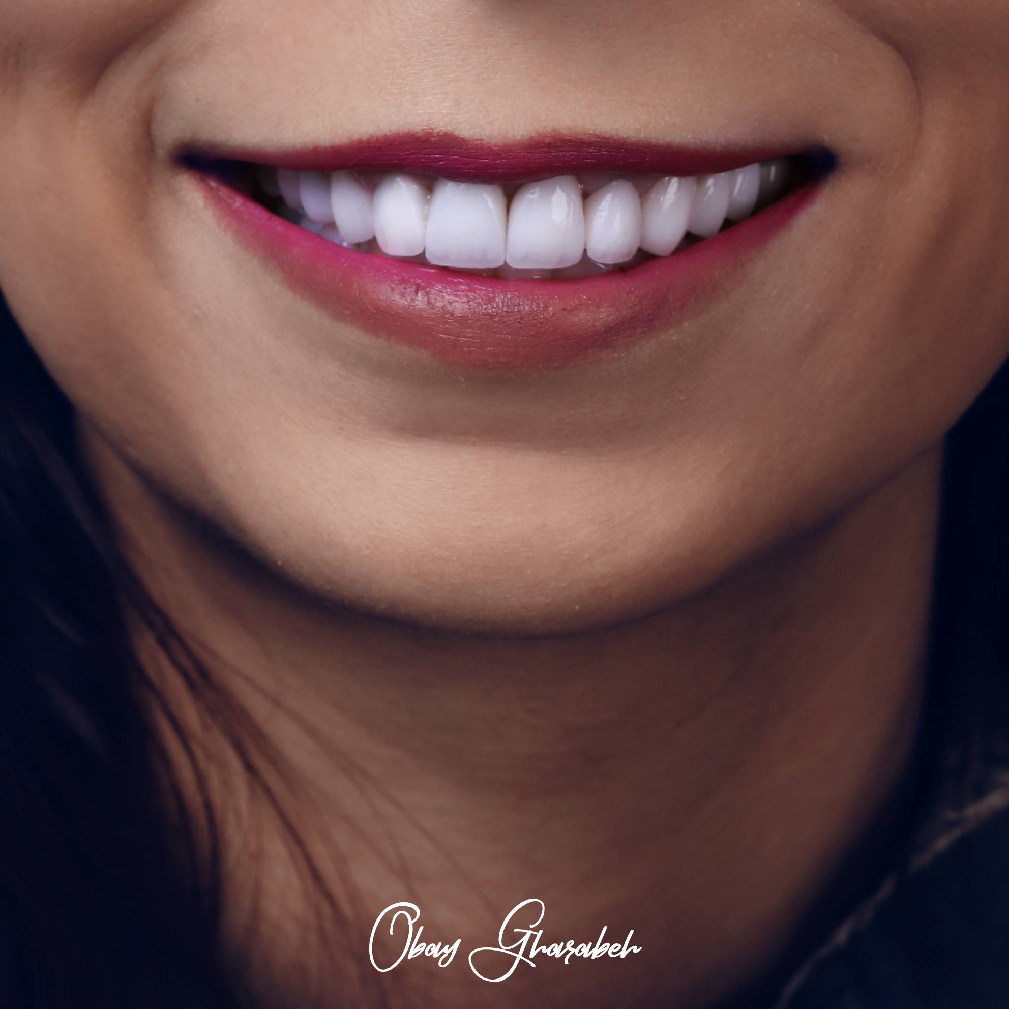 dr.obay gharaba - صورة 4