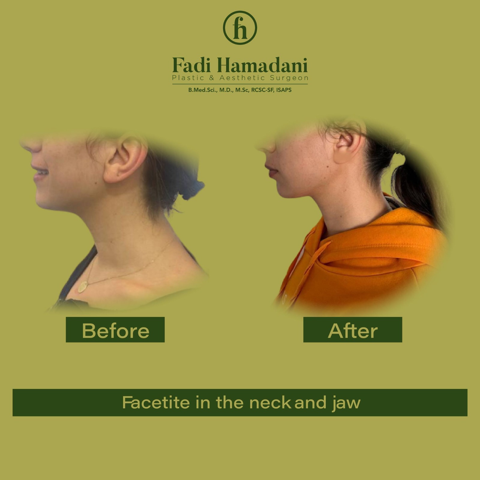 Dr. Fadi Hamadani, Plastic & Aesthetic Clinic - صورة 4