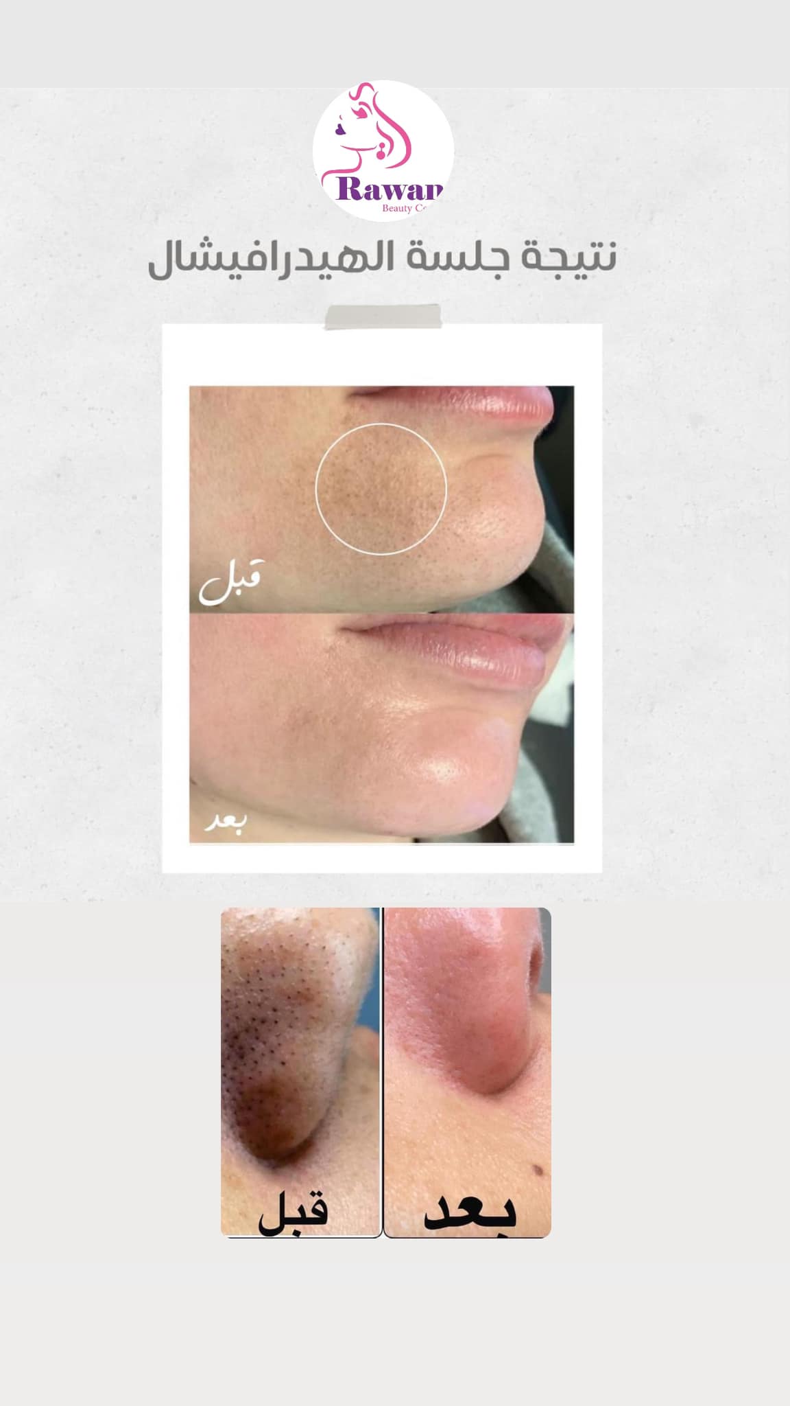 Rawan Beauty Center - صورة 7