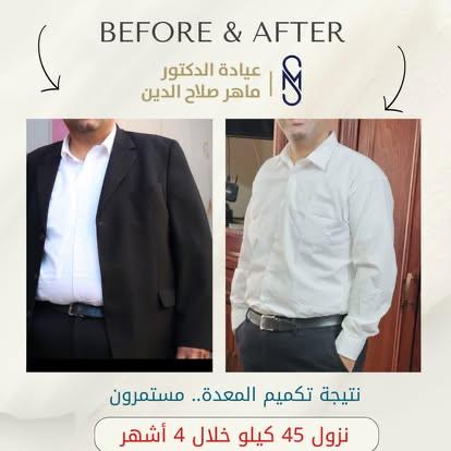 د. ماهر صلاح الدين لجراحة السمنة وشفط الدهون - صورة 2
