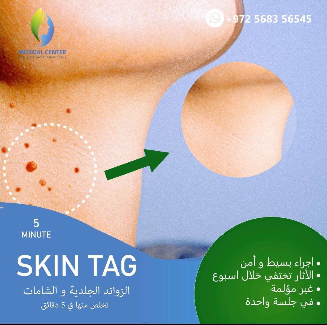 عياده الامراض الجلديه والتناسليه والليزر - صورة 5
