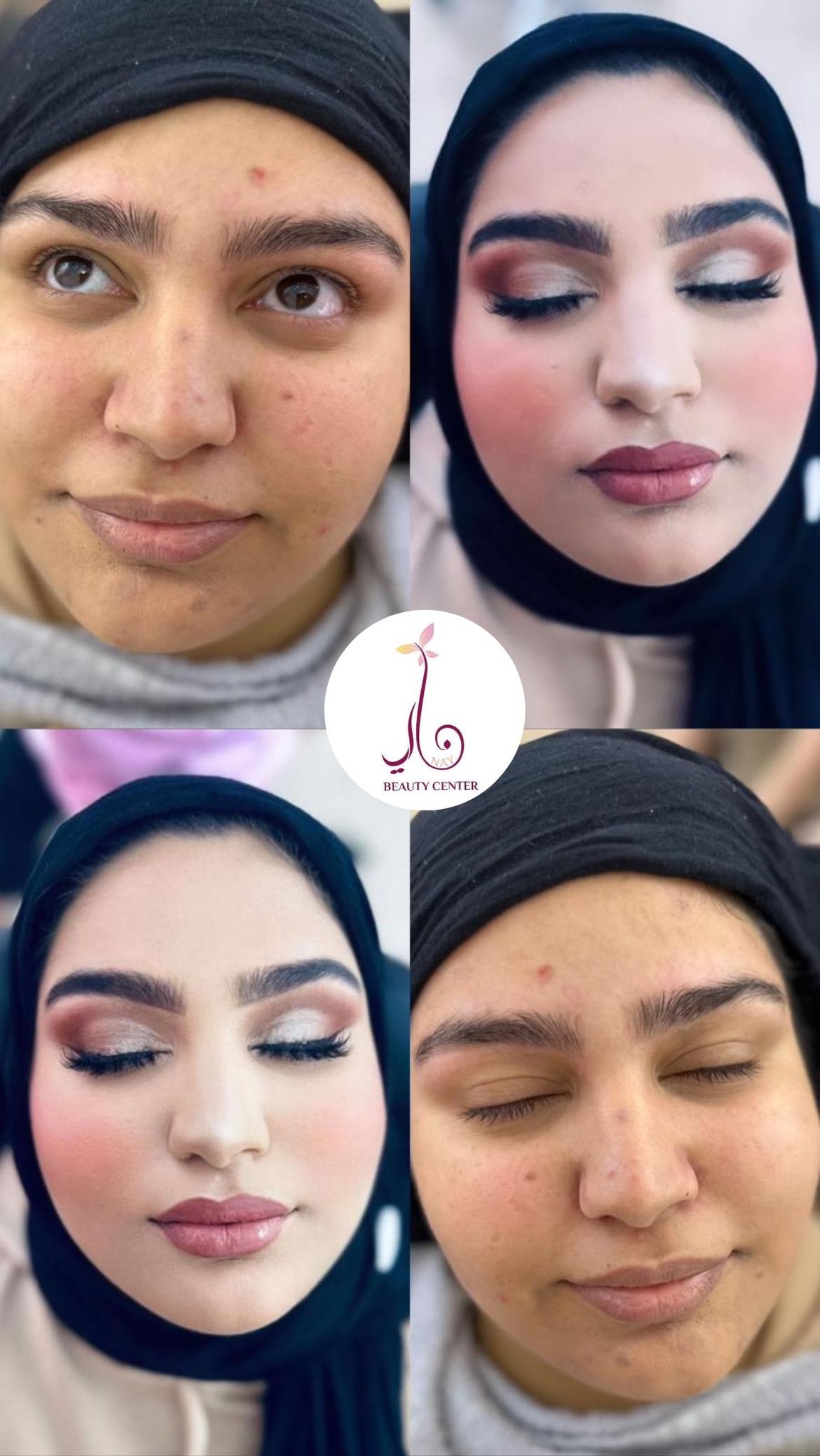 Nay Beauty Center - صورة 5