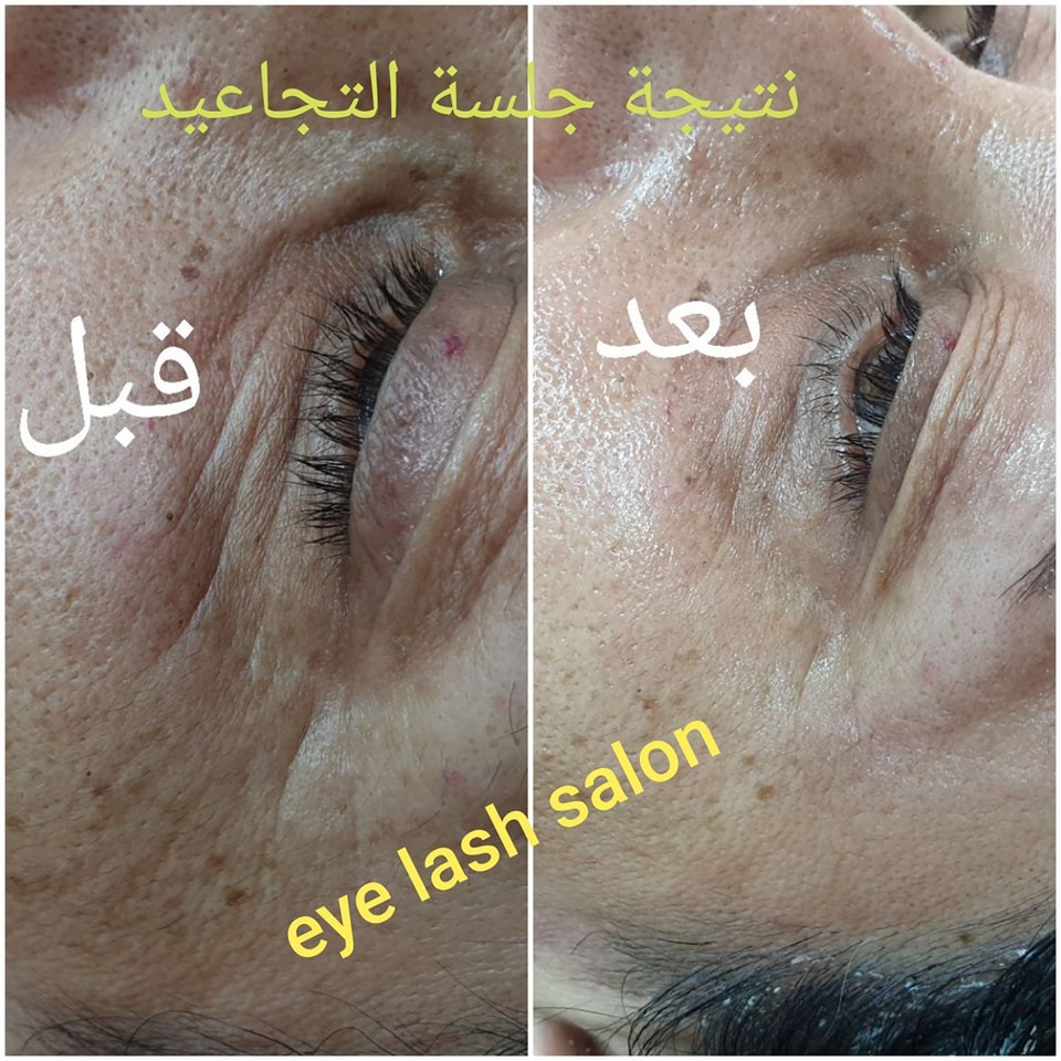 Eye Lash Salon - صورة 4