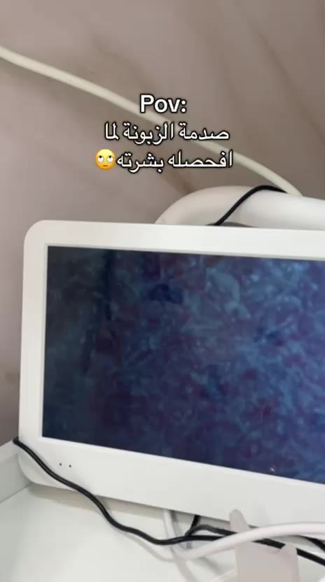 S-M SKIN CARE BEAUTY - فيديو 1